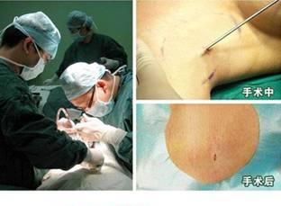 腋臭 狐臭发病原因分析.jpg